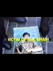 Victim of the Brain