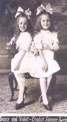 Daisy and Violet Hilton